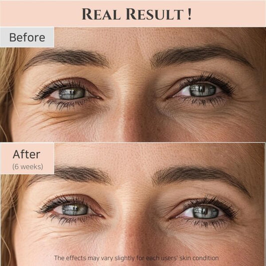 Beauty of Joseon Revive eye serum : Ginseng + Retinal, 30ml,