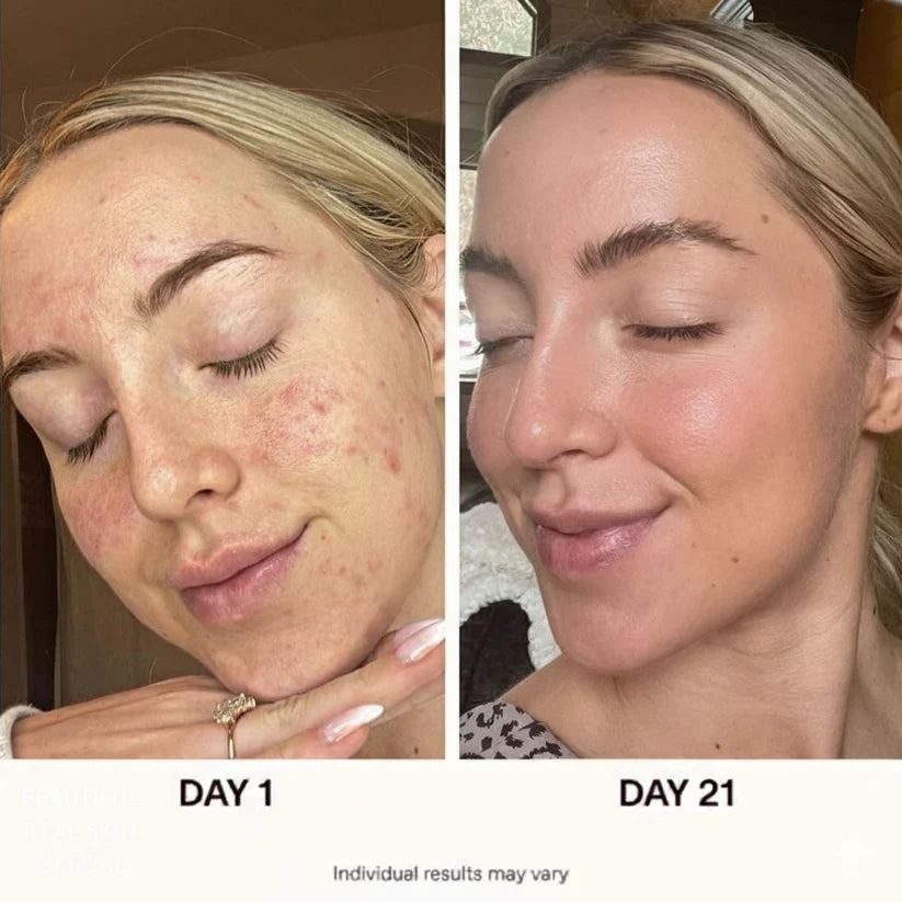 Anua Korean Glass Skin Routine Set